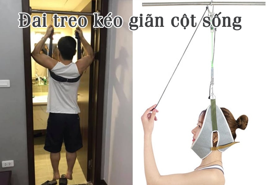 Bệnh cột sống, bệnh thường gặp của những công nhân phải đứng nhiều