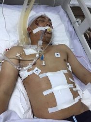Xót xa trước hoàn cảnh éo le của chàng trai bị tai nạn lao động tại Nghệ An