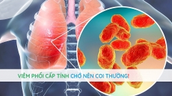 Viêm phổi cấp tính, chớ nên coi thường!