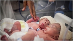 Kỳ lạ: Cặp song sinh ở Ấn Độ được đặt tên “Corona” và “Covid”