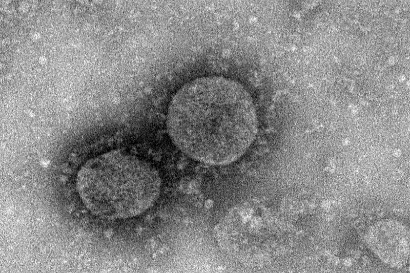 Hồng Kông (Trung Quốc) công bố đã phát triển thành công vắc-xin chống virus Corona