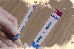 Công an đã vào cuộc điều tra vụ cắt đôi que thử HIV, viêm gan B tại Bệnh viện Xanh Pôn