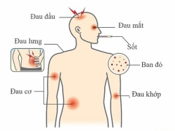 trang bi 4 bien phap phong sot xuat huyet sau day de dam bao suc khoe cho gia dinh