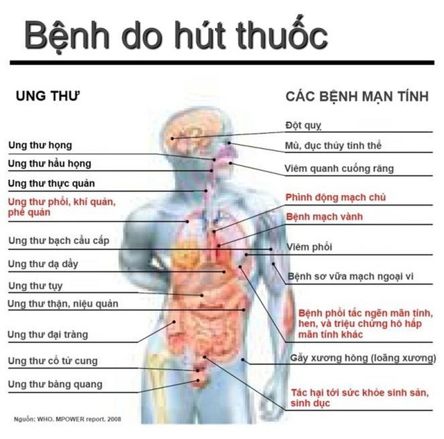 Hút thuốc lá có nguy cơ mắc ung thư phổi cao gấp 10 lần bình thường